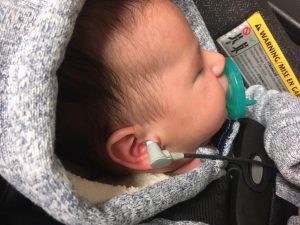 Baby Hearing Assessment